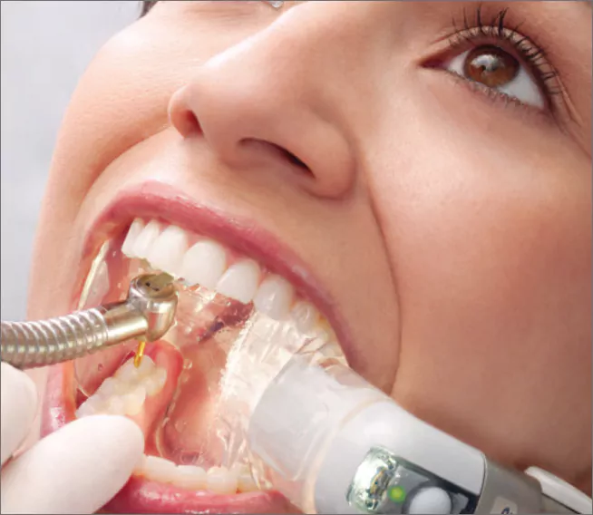The-Isolite-Dental-Isolation-System